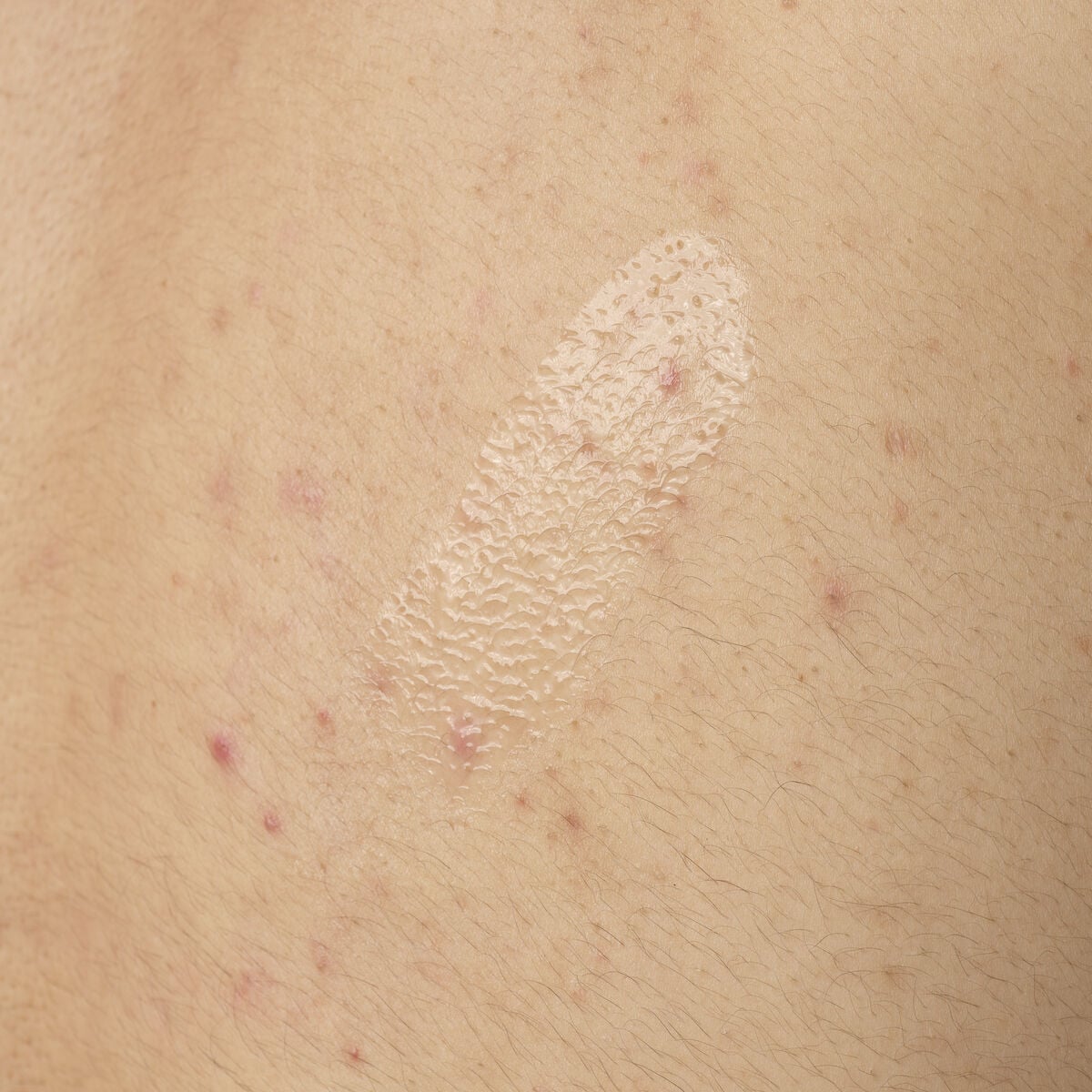 salicylic-acid-0-5-body-serum-c5 ORD-salicylic-acid-05-body-240ml-application.jpg