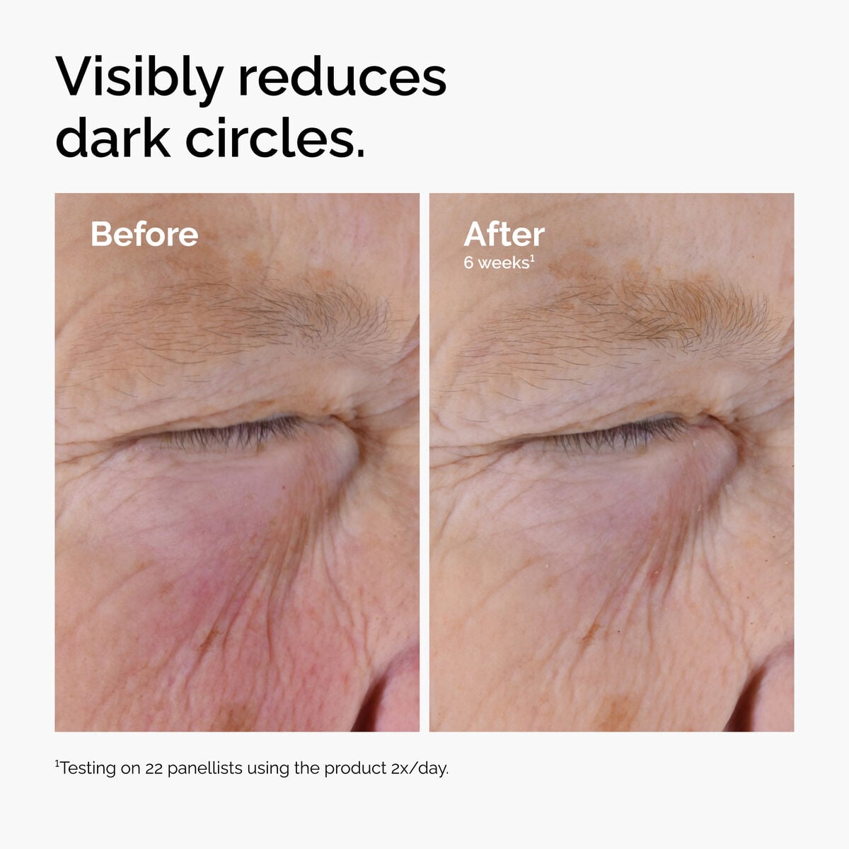 caffeine-solution-5-egcg-eye-serum-p0 ord-caffeine-solution-egcg-dark-circles-before-after.jpg