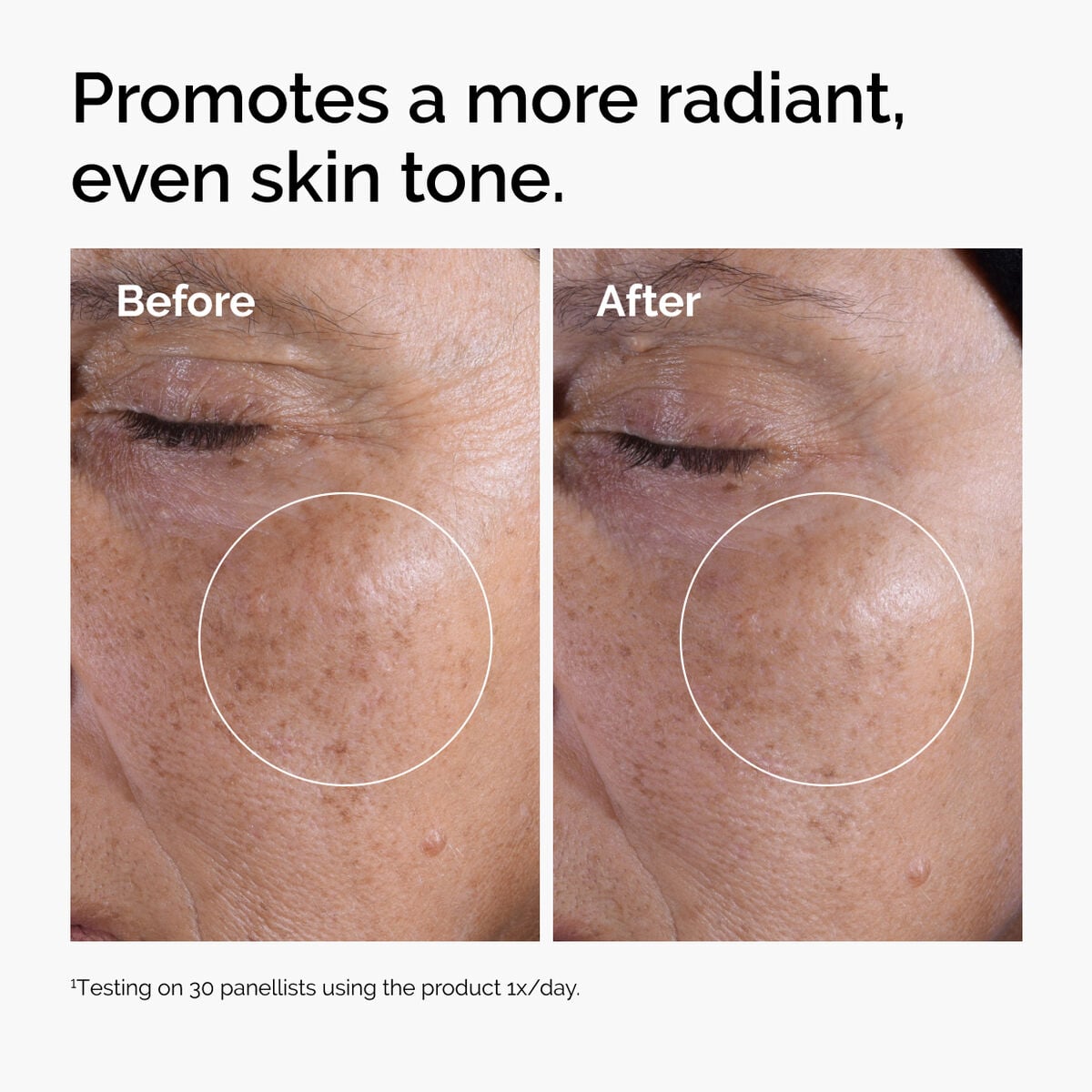 glycolic-acid-7-exfoliating-toner-h3 ord-glycolic-before-after-radiance.jpg