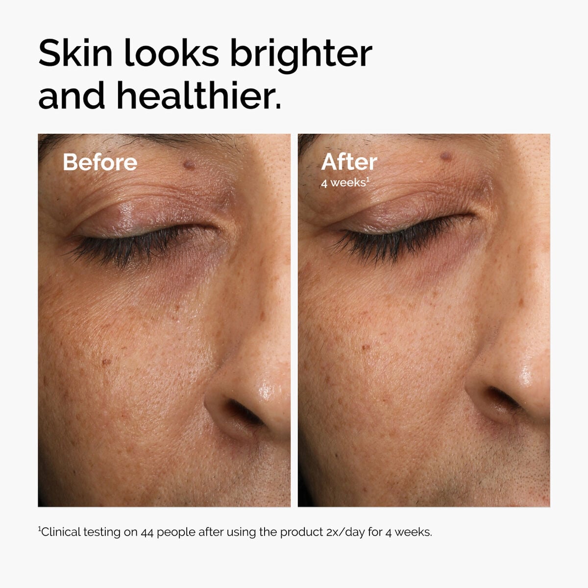 multi-antioxidant-radiance-serum-x2 ord-mars-before-after-healthy.jpg