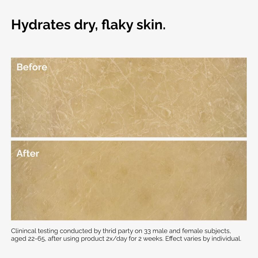 the-body-care-collection-c1 ord-natural-moisturizing-factors-inulin-body-before-after-graphic-02.jpg