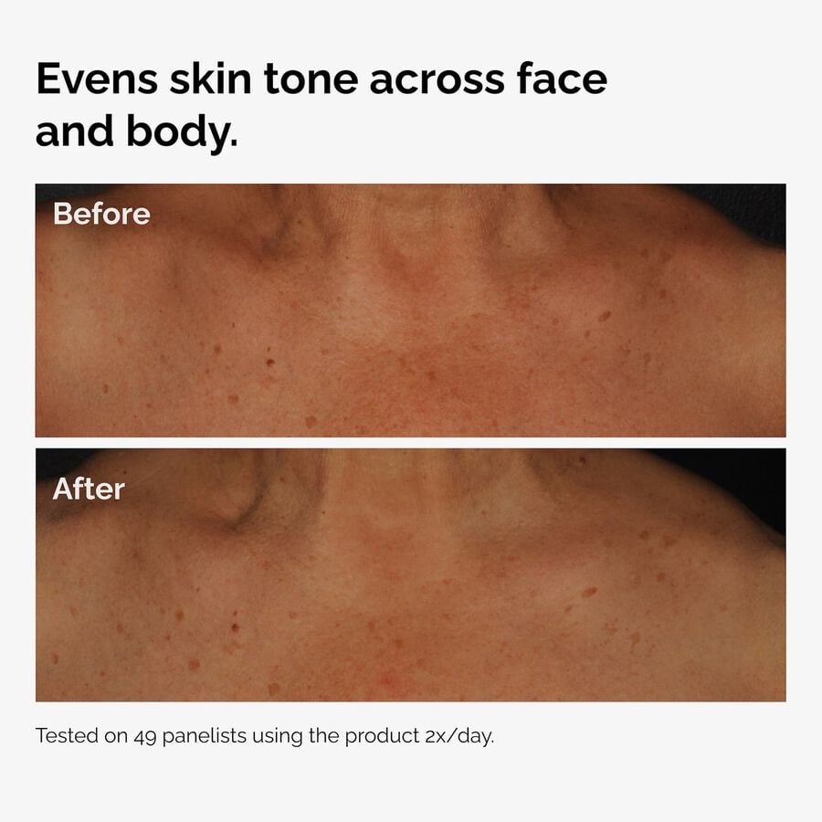 the-body-care-collection-c1 ord-niacinamide-face-body-serum-before-after-even-tone-graphic.jpg