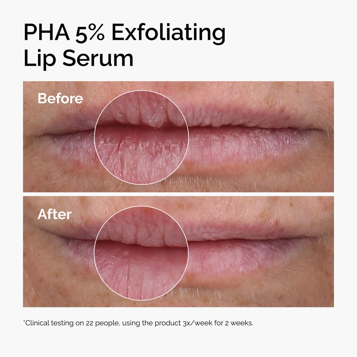 pha-5-exfoliating-lip-serum-p4 ord-pha-5pct-lip-exfoliating-serum-before-after.jpg